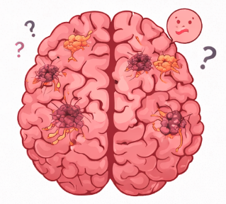 Memory Starts to Fail